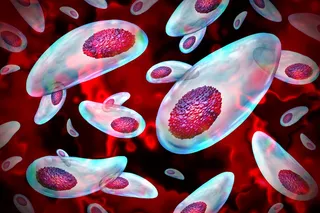 Toxoplasmosis gondii parasite Toxoplasmosis gondii parasite