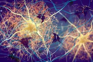3D illustatrion of amyuloid plaque forming in-between neurons