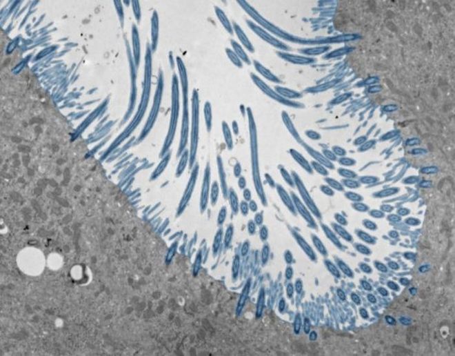 microscope image of human nasal organoids with blue cilia