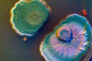 Petri dish of a microbe colony