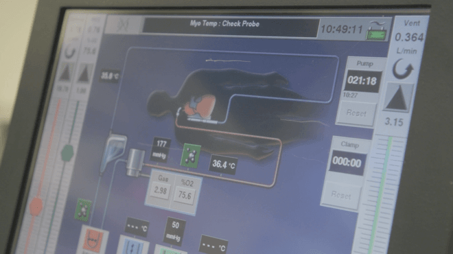 computer monitor screen monitoring oxygen, blood, and temperature levels in a patient