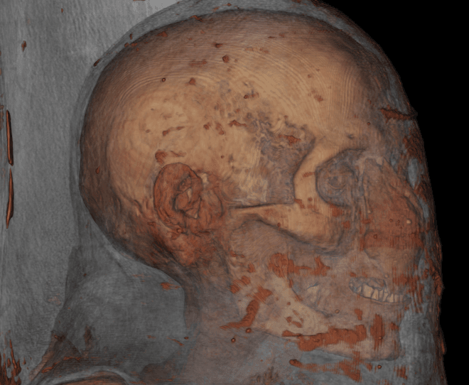 3D model of an ancient mummy skull.