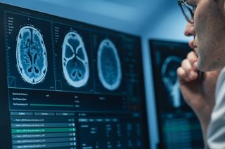 Examining brain scans, image of searching for where fever chills come from Examining brain scans, image of searching for where fever chills come from