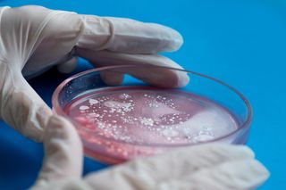 Close-up of petri dish for research on bacteria and viruses