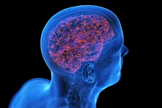Human brain infected with bacteria