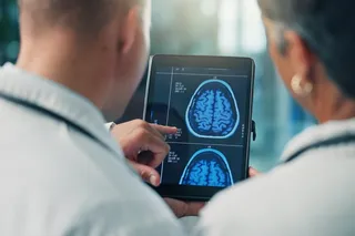 two doctors looking at a brain image 