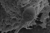 microscopic image of a sperm
