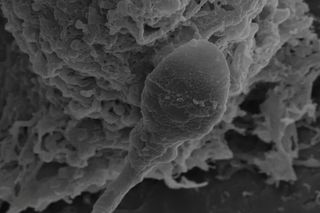 microscopic image of a sperm