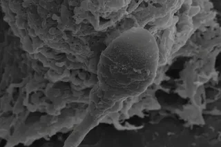 microscopic image of a sperm