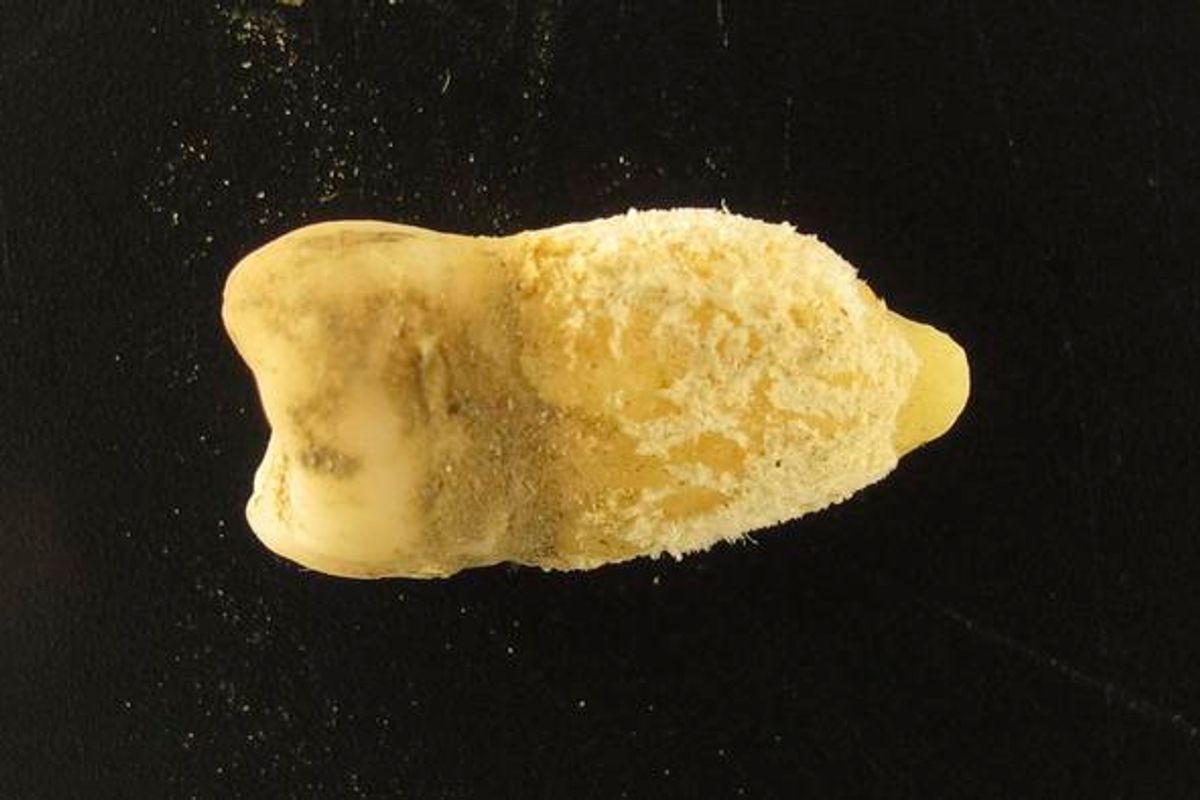 700-Year-Old Mummy’s Tooth Reveals Earliest Scarlet Fever Evidence in the Americas