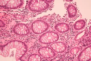 Microscopic image of cancer cells representing tissue structure and DNA repair activity