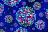 A Hantavirus Outbreak on a Cruise Ship Leaves 3 Dead &mdash; Why Viral Outbreaks Are So Common at Sea