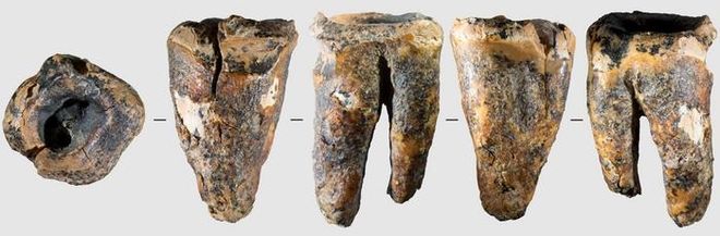 Chagyrskaya 64 molar in five different projections Chagyrskaya 64 molar in five different projections
