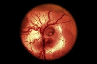 developing chicken embryo 