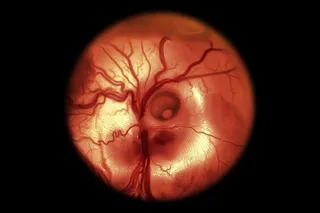 developing chicken embryo 