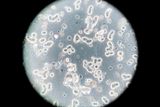 A Common Asthma Drug May Help the Immune System Fight Cancer Again