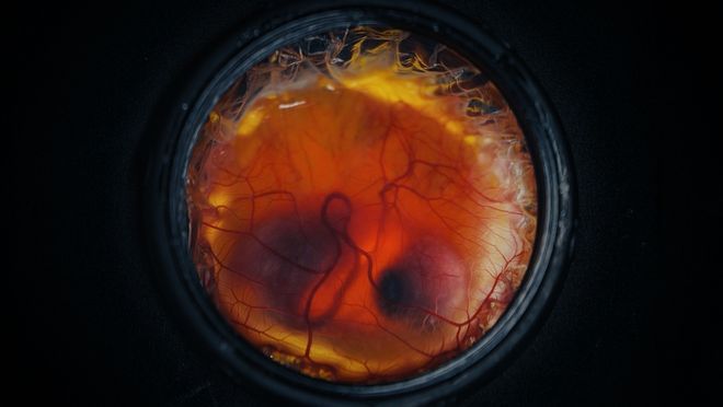 Colossal Biosciences chick embryo