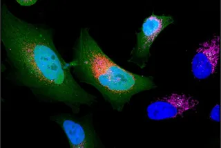 Cancer cell expressing microprotein, relevant to the Peptidein research