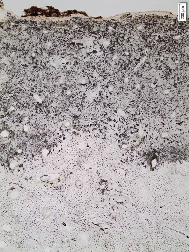 cross section of bone under a microscope 