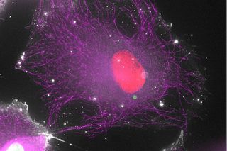 Cell under the microscope is transferring DNA