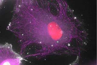 Cell under the microscope is transferring DNA
