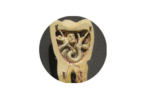 Dentist ... Art? - National Museum of Dentistry