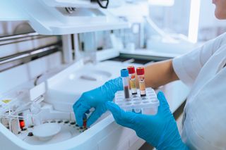 Researcher analyzes blood samples