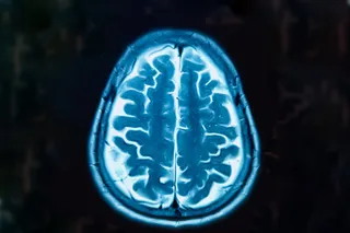 blue and black image of an MRI brain