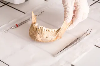 lower human jaw bone with gloved hand and medical instrument 