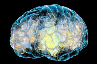 Illustration of a human brain in cognitive decline