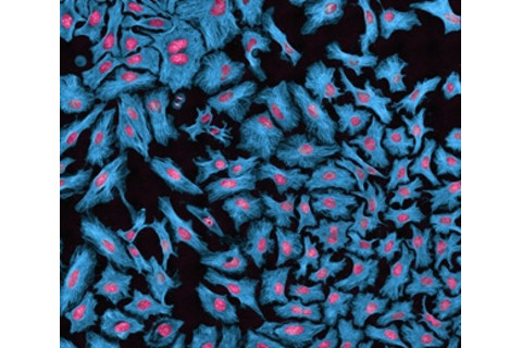 hela-cells-microscope