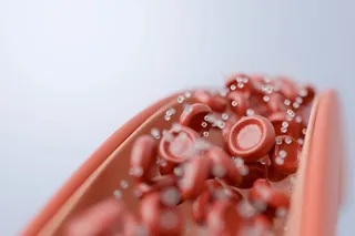 High-glucose sugar levels in the body, sugar in the blood