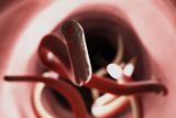Genetically Modified Hookworms Could Become 'Living Drug Factories' for Long-Term Treatments