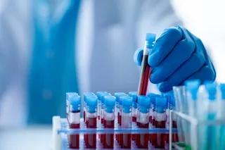 Doctor with vials of blood for a blood test 