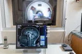 Team scanning the brain with an MRI to research changes in the brain during pregnancy