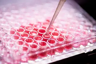 Cell culture