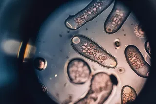 Protozoa under a microscope
