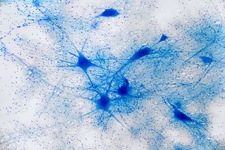 Neurons under the microscope
