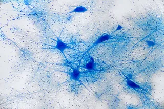 Neurons under the microscope