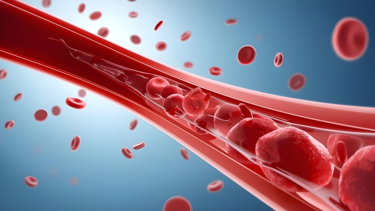 Photo: Discover Magazine Fluid Dynamics and Clinical Potential