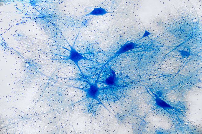 brain neurons under the microscope brain neurons under the microscope