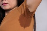 A Tiny Electrical Gate in Nerve Cells May Be Behind Excessive Sweating
