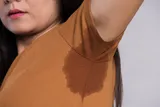 woman with hyperhydrosis, excessive sweating. Wet shirt under the armpit 
