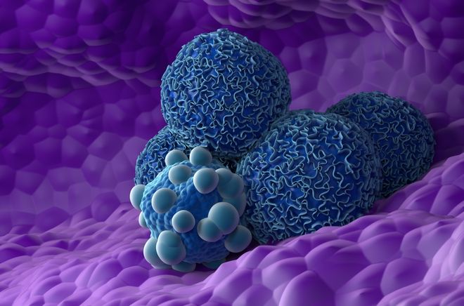 Illustration of pancreatic cancer cells Illustration of pancreatic cancer cells
