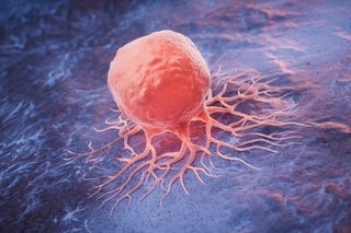 cancer cell spreading in a person