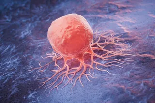 cancer cell spreading in a person