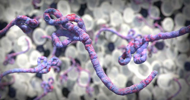Ebola virus under a microscope