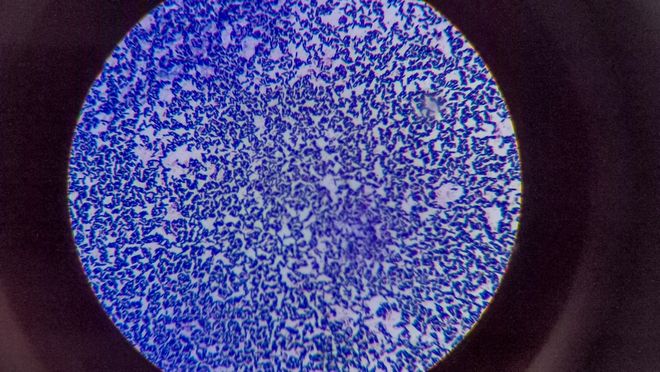 Bacteria under a microscope, supporting germ theory