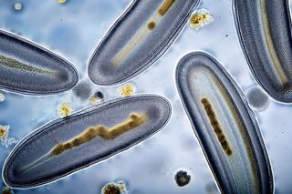 Protozoa under a microscope