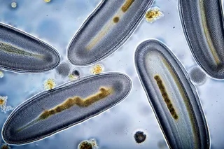 Protozoa under a microscope